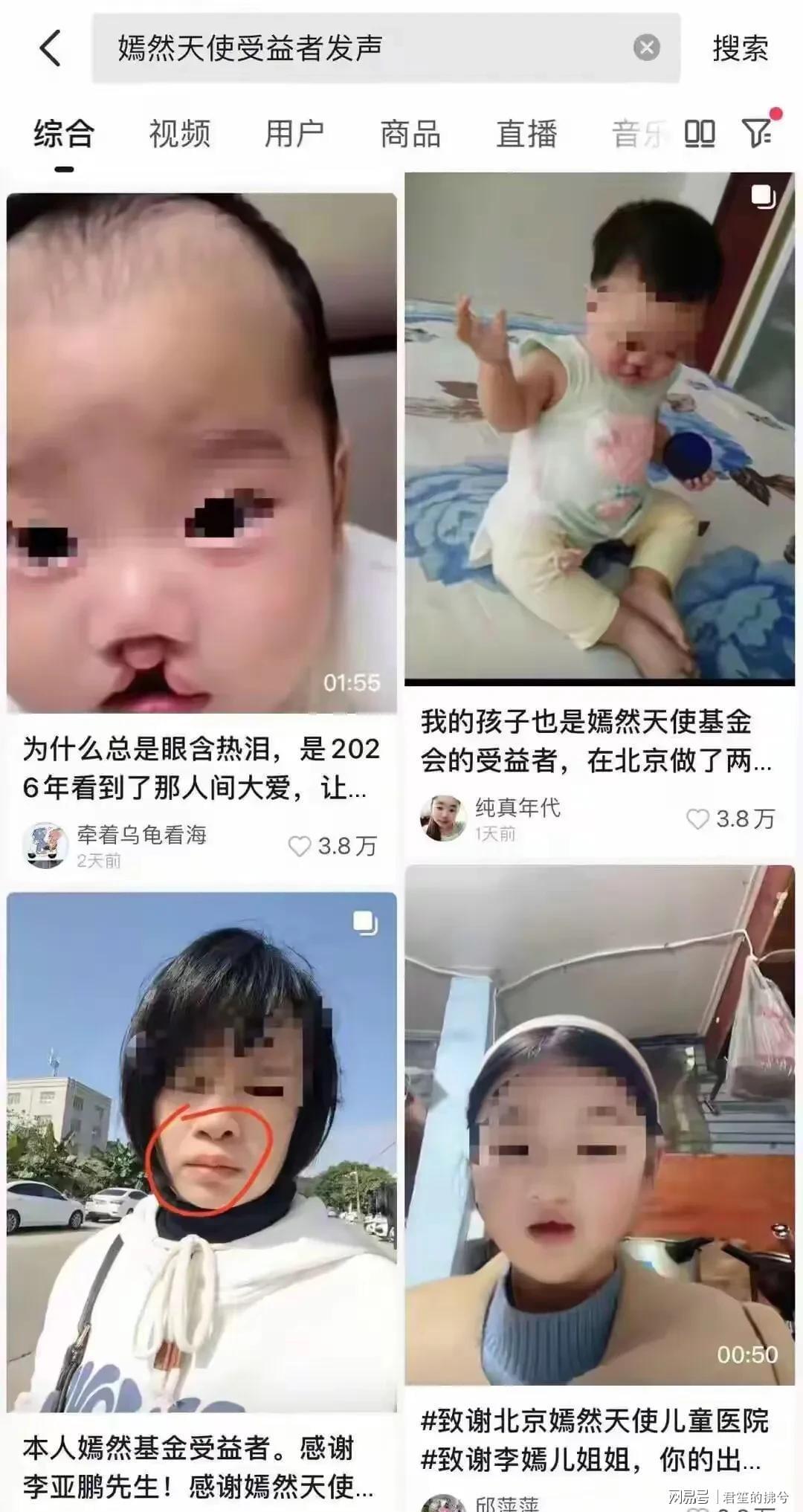 yunkai官网-娱乐圈又丢人！嫣然医院捐款名单曝光，年入上亿明星一个都不吭声